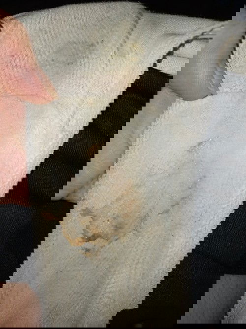 Pasintabi po sa kumakain. Normal lang po ba yan mga mamsh? 39weeks na po ako