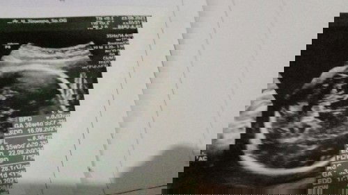 Binggung ttp bhgia🤭