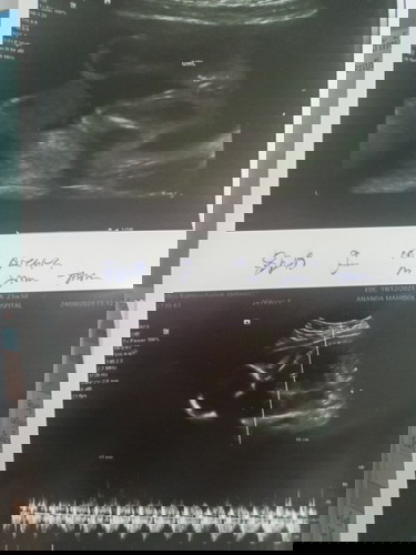 ไตรมาส ที่2 23 สัปดาห์ 4วัน