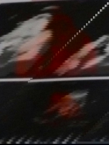 Em bầu được 7 tháng rồi mà lên có 5kg thì có ảnh hưởng đến thai nhi không ạ