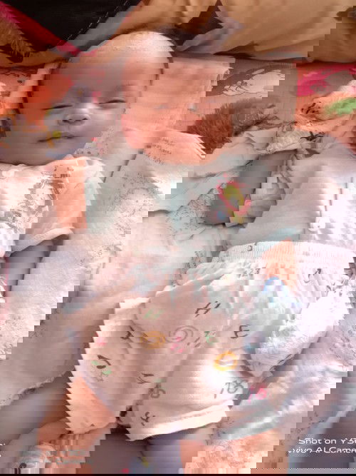 Kepala botak dan banyak keraknya.