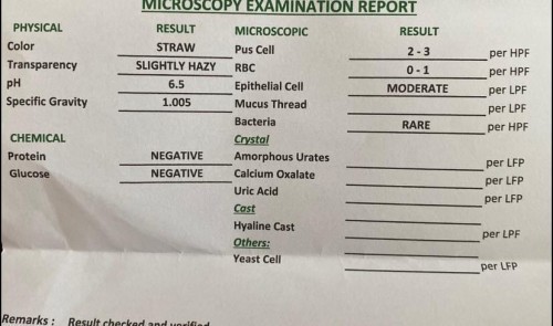 urinalysis result ni baby
