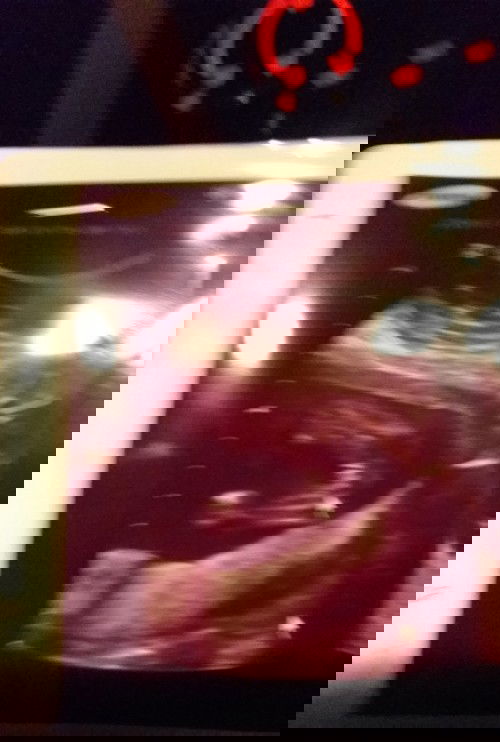 การฉีดยาเข้าหน้าท้องเพื่อคุมเบาหวานเจ็บใหมอ่ะกังวลจังคุณแม่กลัวเข็มจัง#8เดือนแล้วเพิ่งได้ฉีดจร้าทำไม