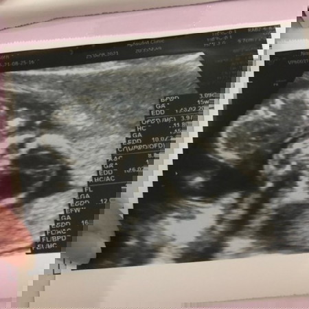 ช่วยตั้งชื่อให้ผมหน่อยค่าบบ