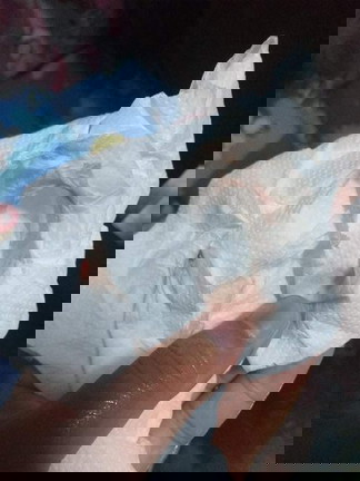 ใช่มูกเลือดไหมคะ