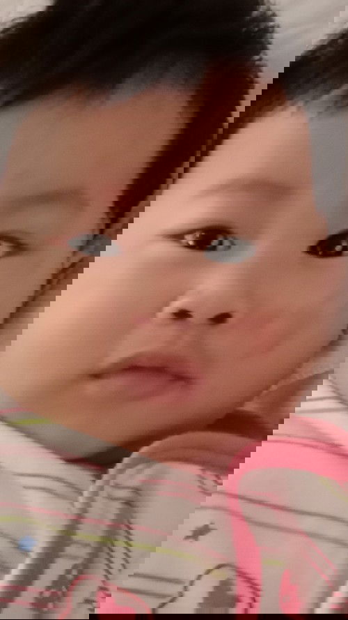 สอบถามแม่ๆหน่อยคะ ลูกมีผื่นขึ้นที่แก้ม ไม่หายสักทีเหมือนยิ่งลามไปกันใหญ่ไม่รู้ว่าแพ้อะไรเหมือนกันค่ะ