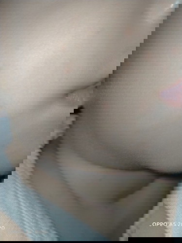 Butlig na maliliit kay baby rashes po ba yan meron din sya sa likod at braso pero medyo pula