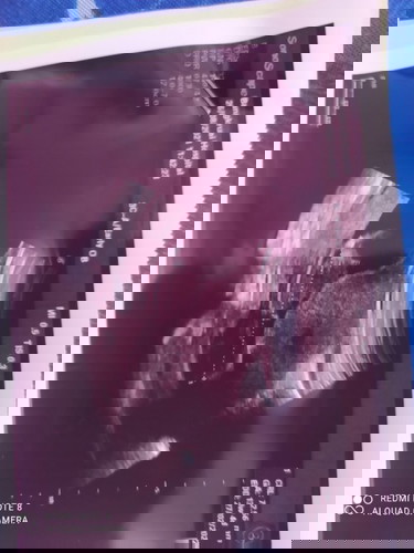 ทราบอายุครรภ์วันคลอดน้องแล้ว เย้ๆๆๆ 13w4d คลอด27/2/2022