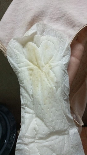 สอบถามผู้รู้ทีค่ะใช่อาการน้ำเดินมั้ยคะ 36+2วีคค่ะ