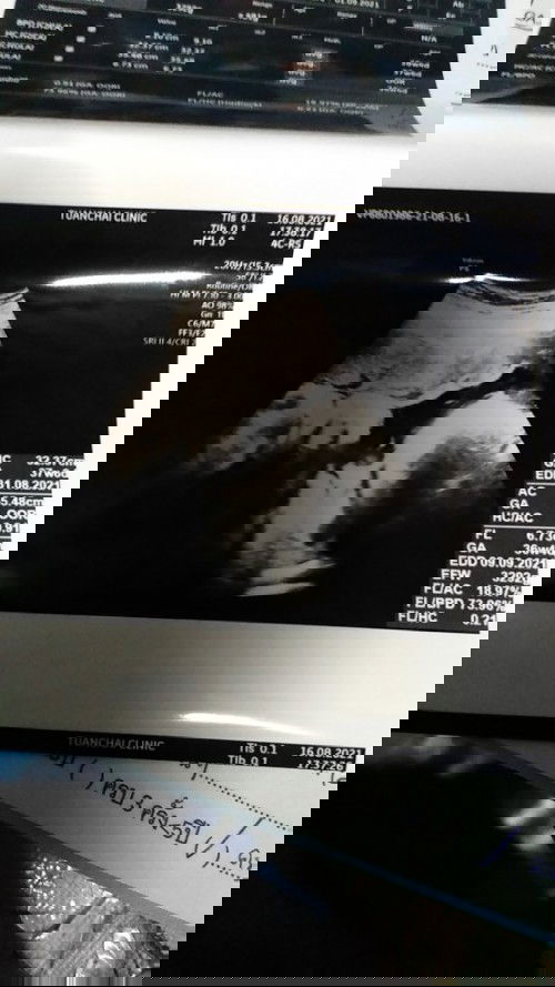 นับวันรอ..