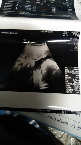 นับวันรอ..