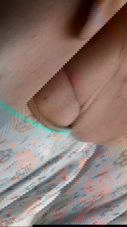 Kena cacar masih bayi