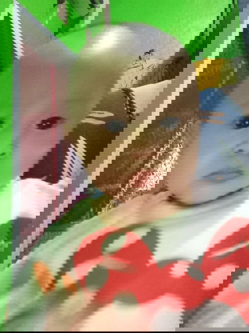 Bayiku matanya sipit sebelah..adakah yang sama bun