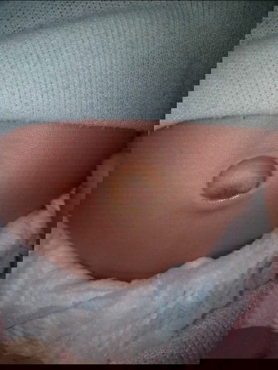 Pusar bayi yang setelah beberapa Minggu Puput jadi agak basah