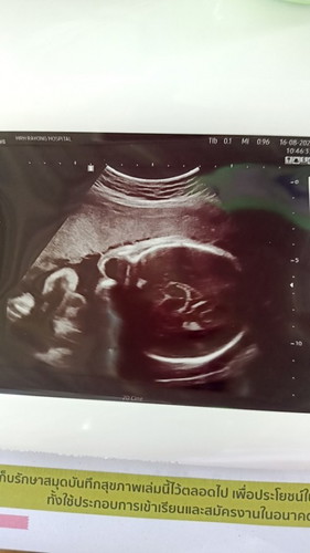 ตั้งครรภ์ท้อง2