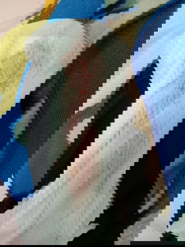 ใครเคยมีเลือดออกแบบนี้ขณะตั้งครรภ์บ้างคะ