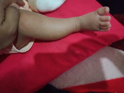 Kaki bayi pengkar