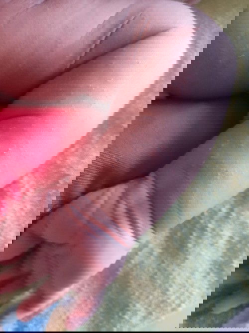 Iritasi atau alergi atau apa yah?