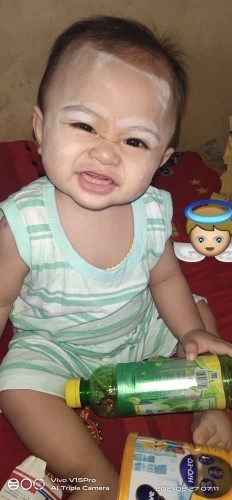 8 bulan belum tumbu gigi