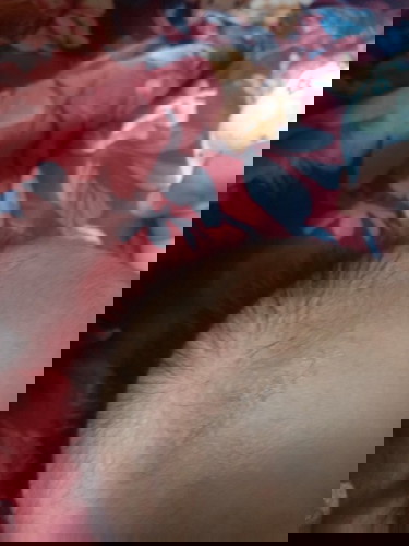 masalah kulit di pipi serta atas kepala