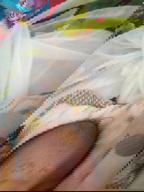 Bintik bintik merah di jidat bayi