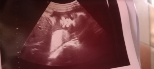 ðΰāđāļāļāļāļĩāđāļĨāļđāļāļŠāļēāļ§āļŦāļĢāļ·āļāļĨāļđāļāļāļēāļĒāļāļ°