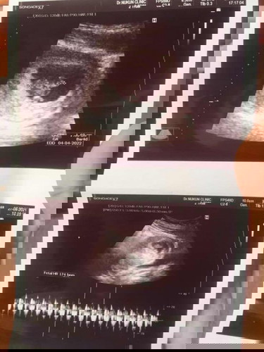 👶2 เดือน4 วัน