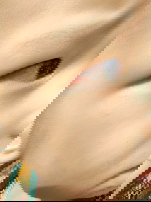 Mắt con e bị như này có sao k các mom
Do dịch e có chụp hình đi ra tiêm thuốc hỏi  ngt nhưg vẫn lo