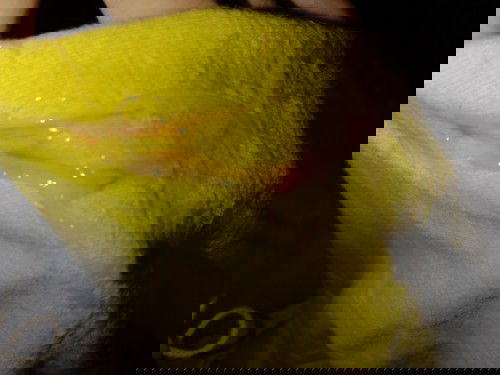 ตอนนี้ท้องได้37+6wค่ะ