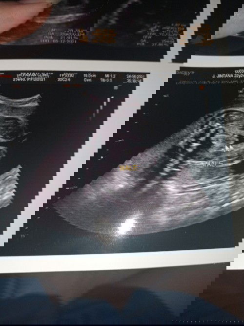 ช่วยดูใบซาวเพศ