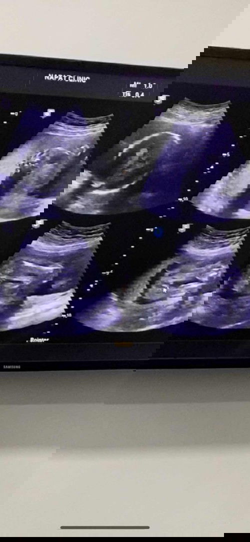 ลูกสาว หรือ ลูกชาย แม่ๆว่าไง