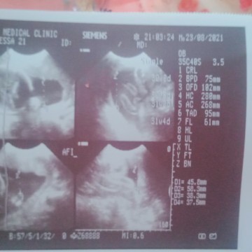 ultrasound