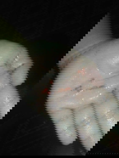 Air Liur Berdarah Setelah Muntah