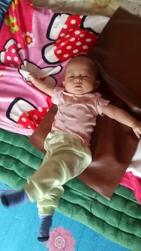 Bun.. Saya sedih sekali. Adakah yg seperti anak saya ini? Dy suka kaku gtu. Dari umur 2 bulan. Saat