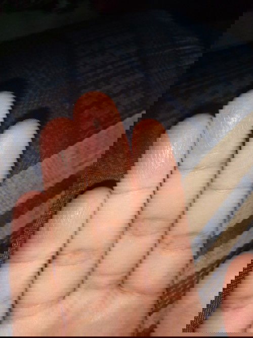 Kulit jari pecah pecah