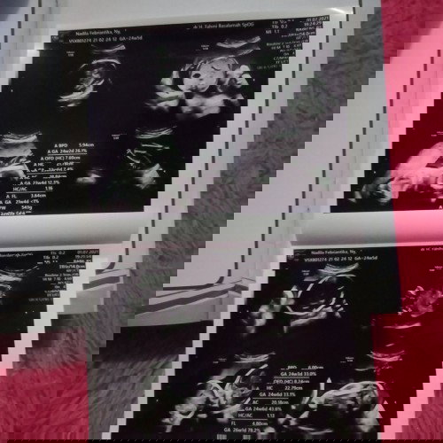 Mau tanya dong bun,,