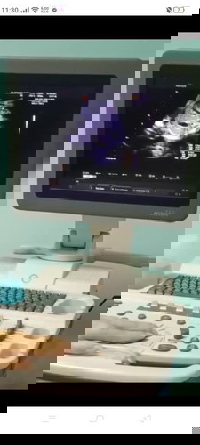 ขอสอบถามค่ะ8เดือน