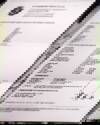 ตรวจคัดกรองดาวน์ซินโดรม