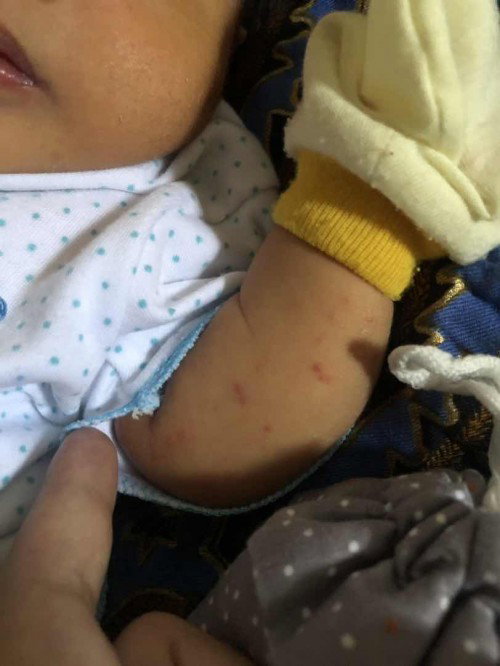 Bintik kemerahan/ruam kulit