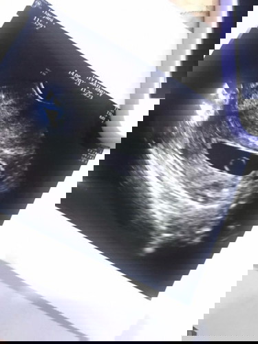 Xde heartbeat lagi 🥺🥺