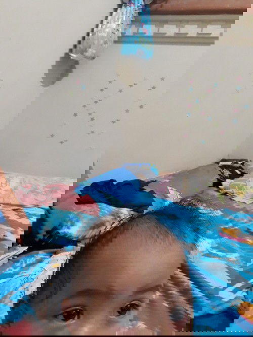 Kantung Mata Bayi Merah