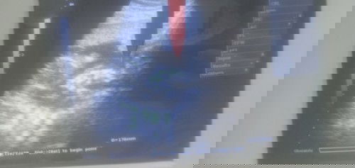 ท้องเล็กไปไหมคะ