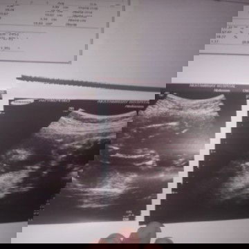 อยากสอบถามแม่ๆคะ ภาพแรกได้ผญรึผชคะ ภาพที่2อิแม่ดูไม่ออกคะว่าหน้าลูกอยู่ตรงไหนแนะนำหน่อยนะค่ะ#ท้องแรก