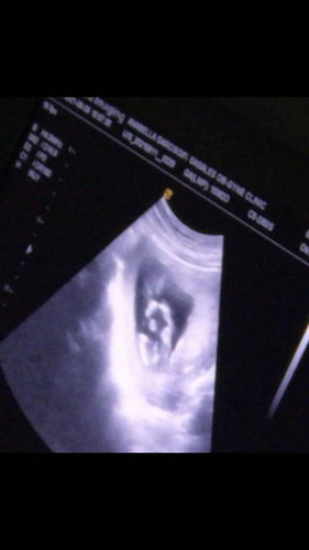 Ano po gender ng baby ko?