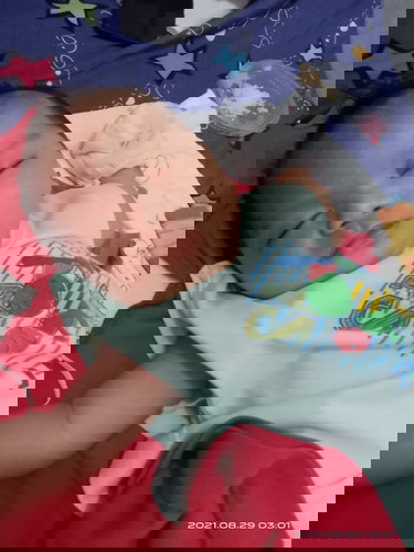 Normal ba Ang laging nagugulat?