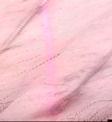 Please help po yung sa bandang dulo po kasi butas na po ba yan?