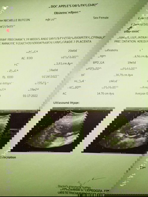 Okay lang po ba yong result ng ultrasound ko? 😌