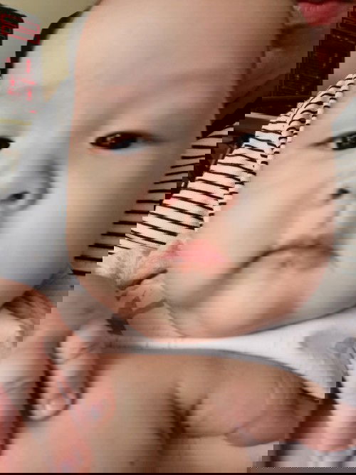 นมไหลออกจากจมูกแต่ไม่สำลัก