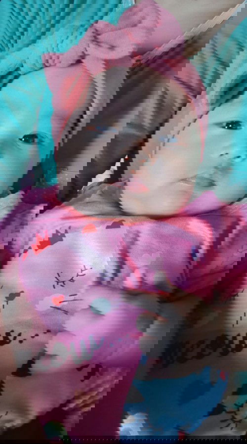 Mata kiri tidak sejajar dengan sebelah kanan