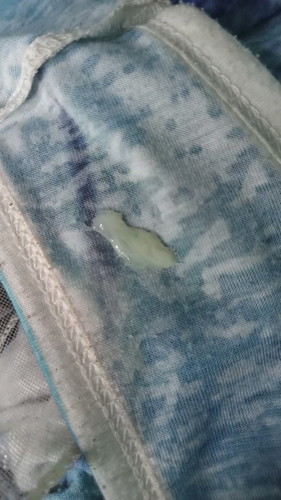 mucus plug?